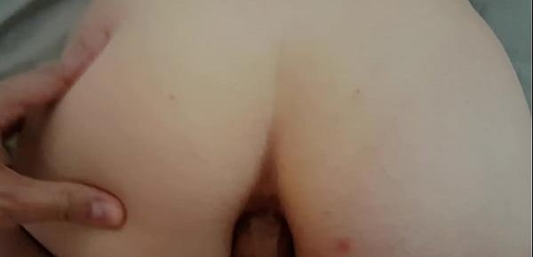  Casal anal
